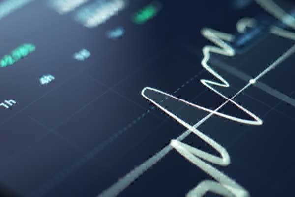 主次节奏：2.13一句话看懂黄金Gold